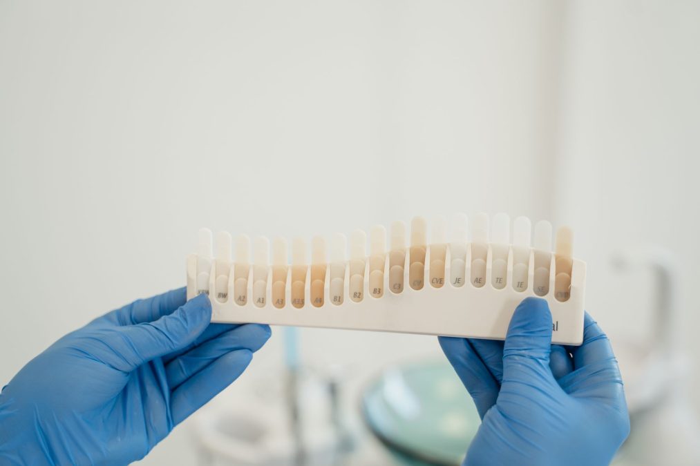 Teeth Whitening Strips: Do They Actually Work in 2026? A Dental Hygienist's Review